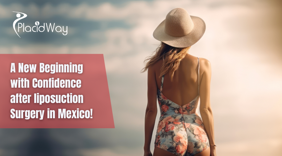 liposuction in mexico city