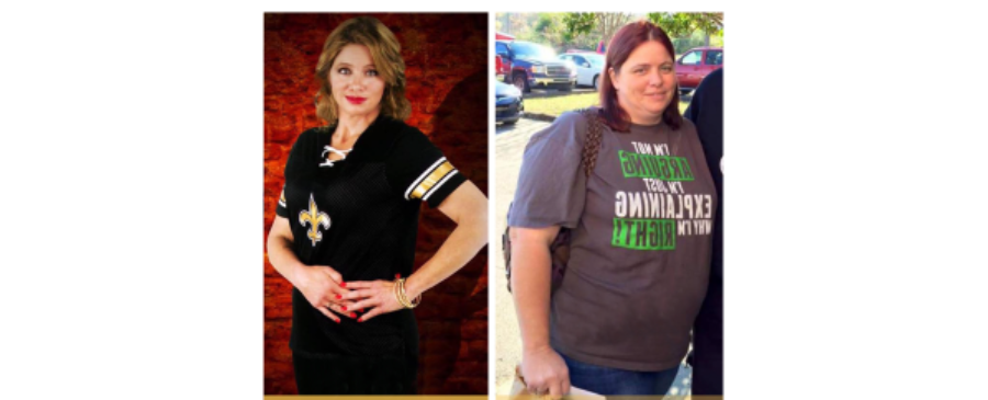 Transforming Her Life with Gastric Sleeve Surgery in Tijuana Mexico