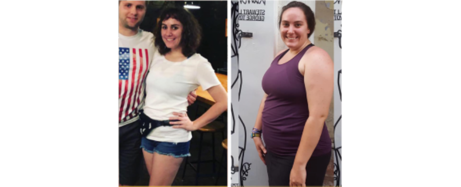 Annie 130-Pound Weight Loss Journey with Gastric Bypass in Tijuana, Mexico