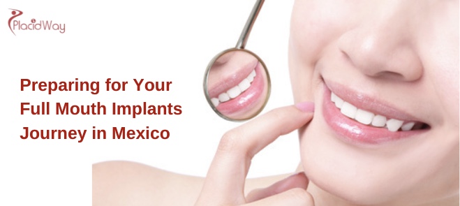 full mouth implants mexico