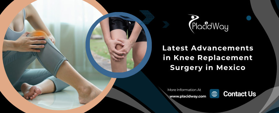 Latest Advancements in Knee Replacement Surgery in Mexico