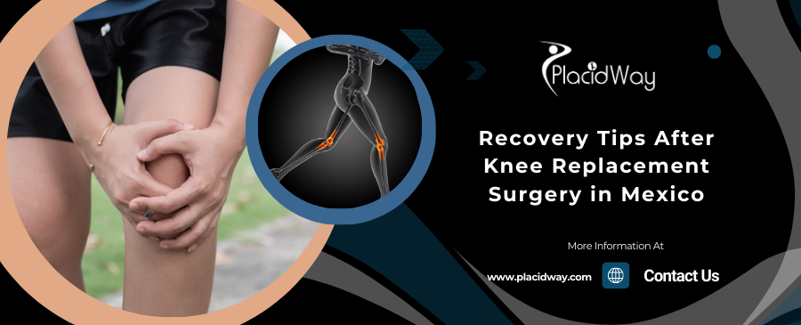 Recovery Tips After Knee Replacement Surgery in Mexico