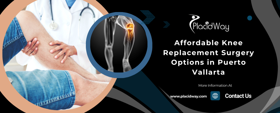 Affordable Knee Replacement Surgery Options in Puerto Vallarta