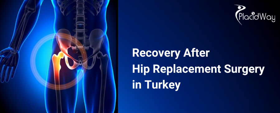 hip replacement surgery in Turkey 