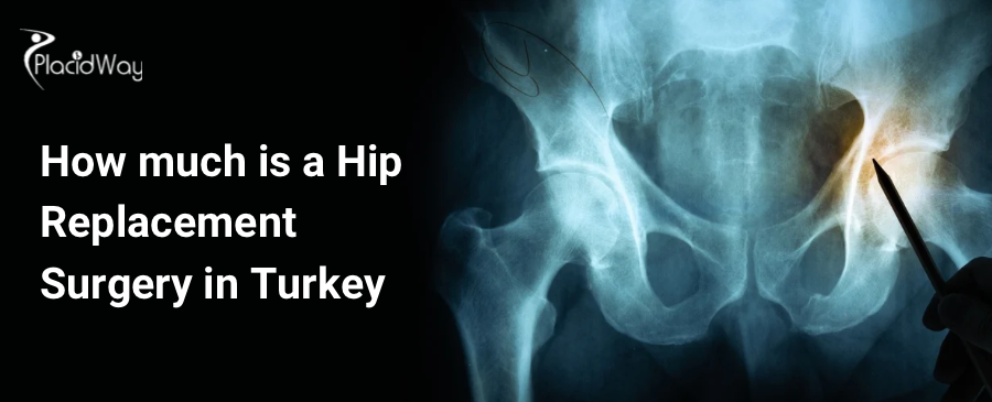 How much is a Hip Replacement Surgery in Turkey