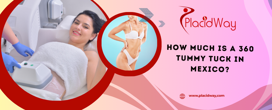 How Much is a 360 Tummy Tuck in Mexico?