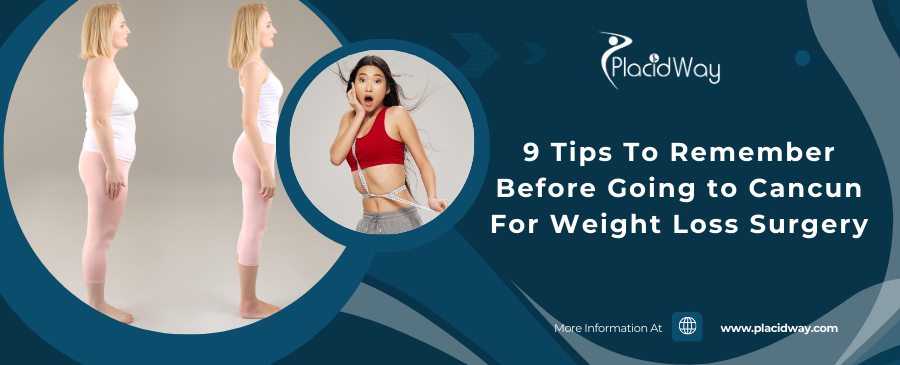 9 Tips To Remember Before Going to Cancun For Weight Loss Surgery