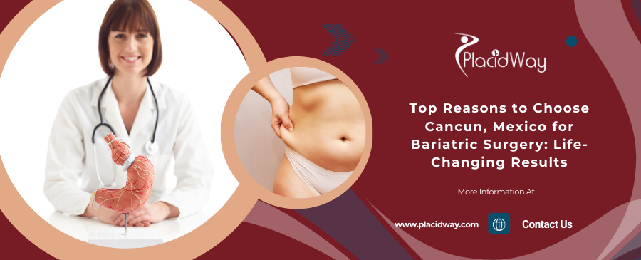 Top Reasons to Choose Cancun, Mexico for Bariatric Surgery: Life-Changing Results