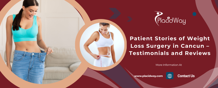 Patient Stories of Weight Loss Surgery in Cancun – Testimonials and Reviews