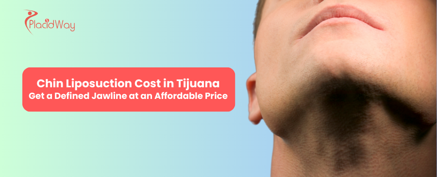 Chin Liposuction cost in Tijuana Mexico