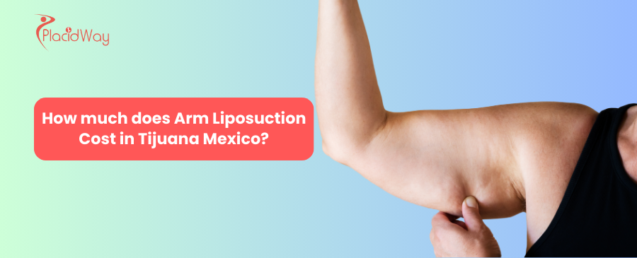 arm liposuction cost in tijuana mexico