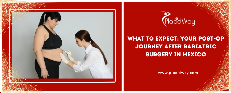 What to Expect: Your Post-Op Journey After Bariatric Surgery in Mexico