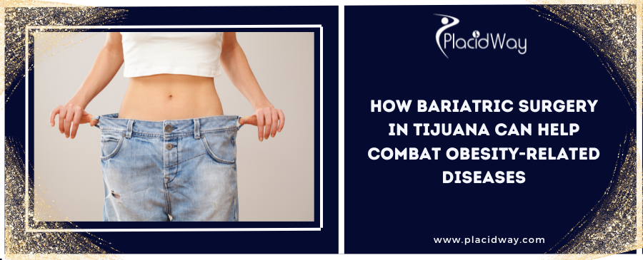 How Bariatric Surgery in Tijuana Can Help Combat Obesity-Related Diseases