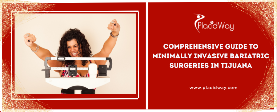 Comprehensive Guide to Minimally Invasive Bariatric Surgeries in Tijuana