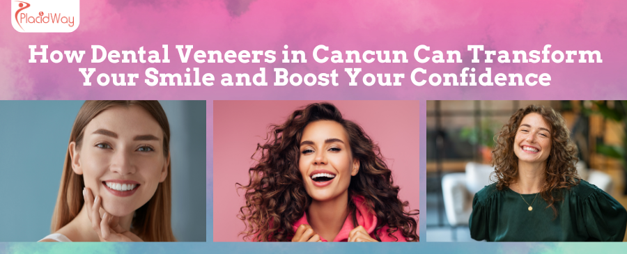 How Dental Veneers in Cancun Can Transform Your Smile and Boost Your Confidence