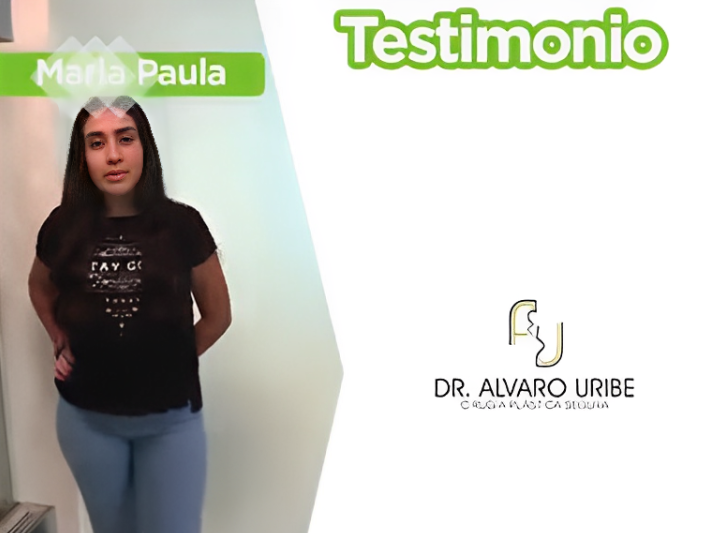 Rinoplastia en Barranquilla Colombia María Paola