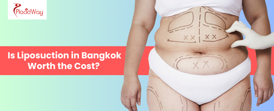 Liposuction in Bangkok Thailand