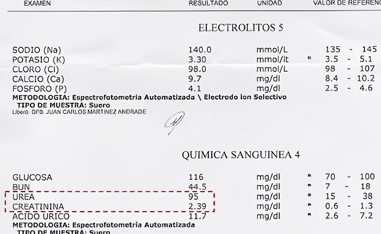 Stem Cell Therapy for Kidney Failure at MexStemCells in Mexico City, Mexico