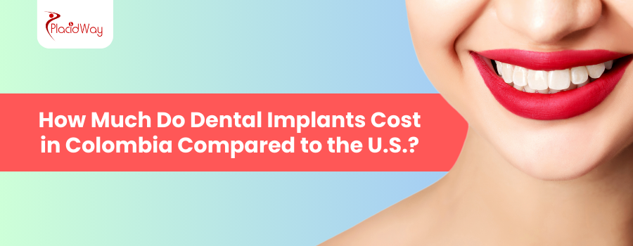 Dental Implants Cost in Colombia