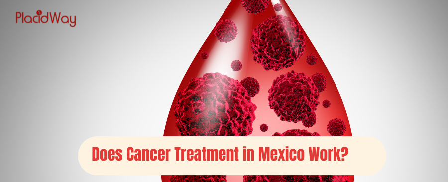 Does Cancer Treatment in Mexico Work