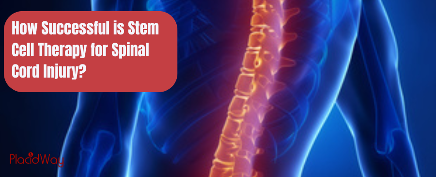 How Successful is Stem Cell Therapy for Spinal Cord Injury?