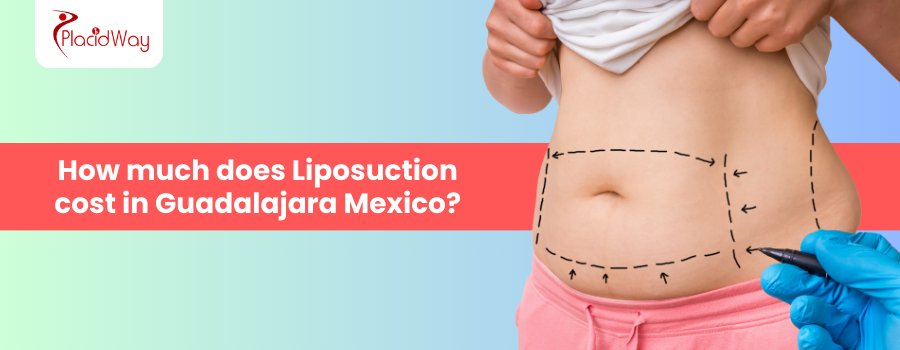 Liposuction Cost in Guadalajara Mexico