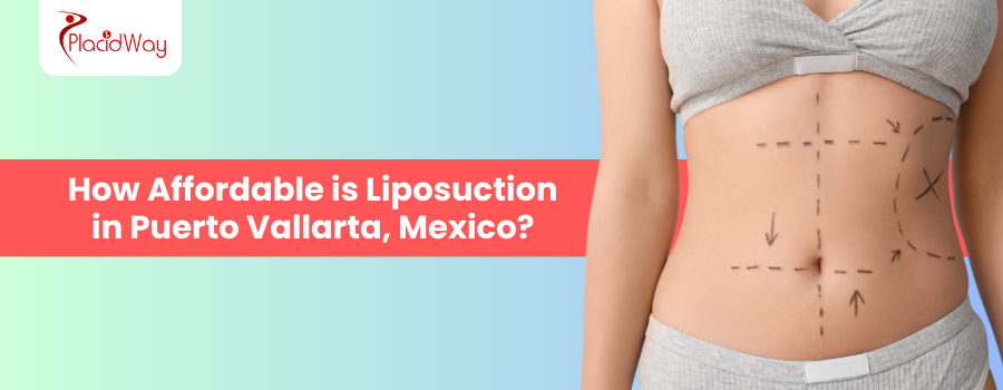 Liposuction in Puerto Vallarta, Mexico