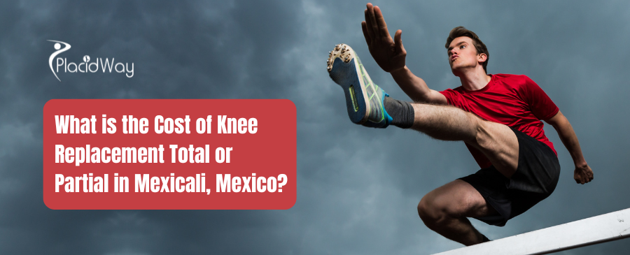 What is the Cost of Knee Replacement Total or Partial in Mexicali, Mexico