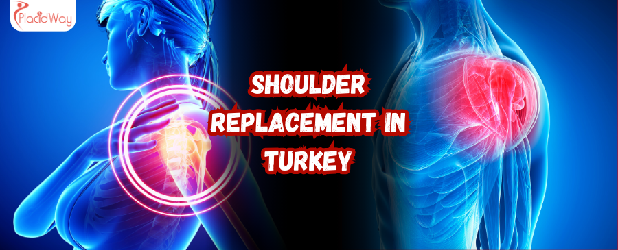 Shoulder Replacement in Turkey