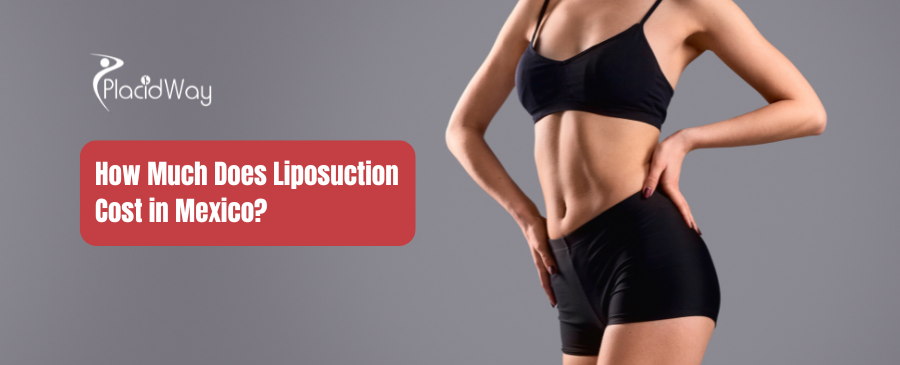 What is the Cost of Liposuction in Mexico