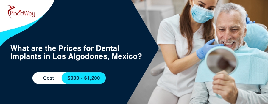 What are the Prices for Dental Implants in Los Algodones, Mexico?