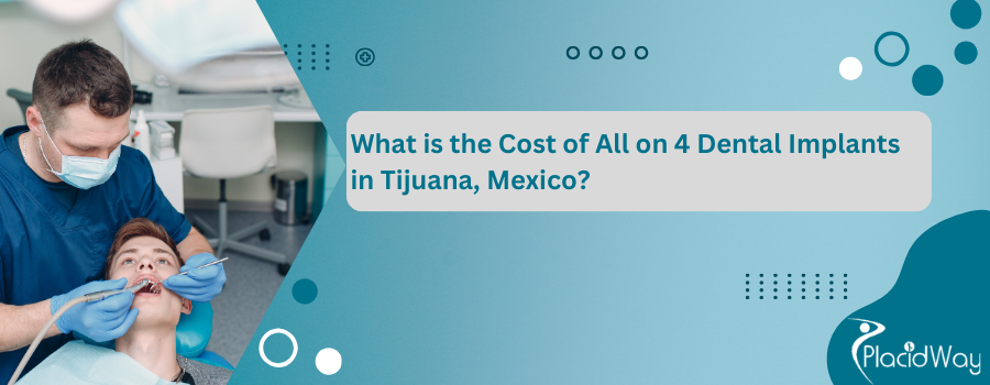 Cost of All on 4 Dental Implants in Tijuana, Mexico