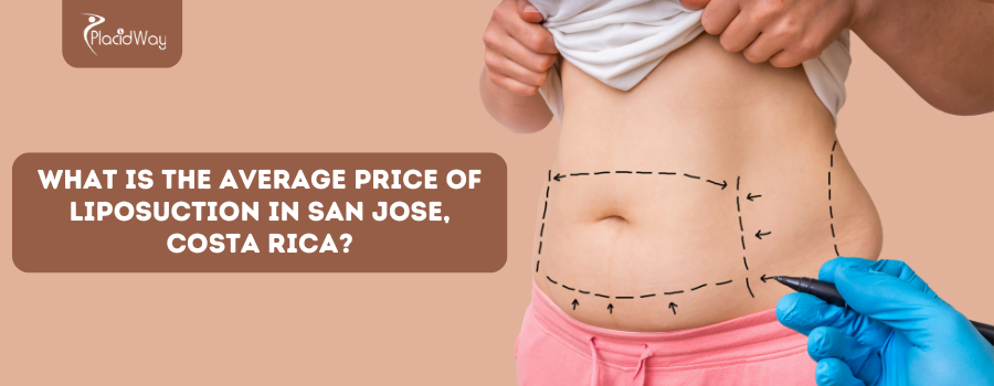 What Is The Average Price Of Liposuction In San Jose, Costa Rica?