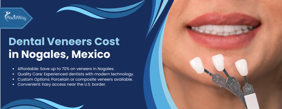 Dental Veneers in Nogales, Mexico