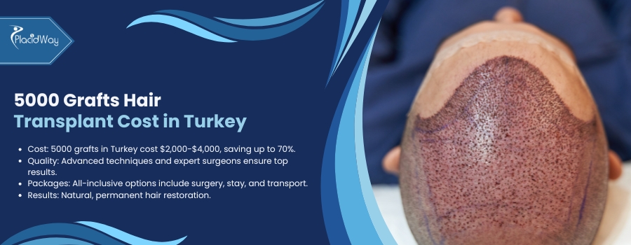 5000 Grafts Hair Transplant Cost in Turkey