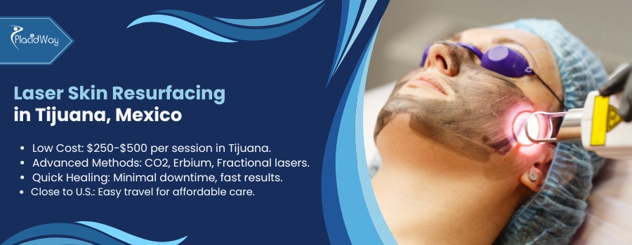 Laser Skin Resurfacing in Tijuana, Mexico