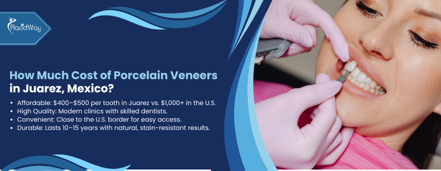 Cost of Porcelain Veneers in Juarez, Mexico