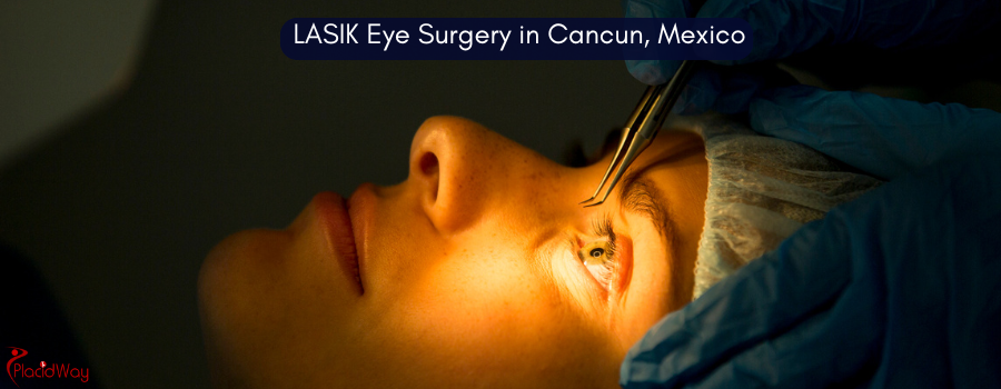 LASIK Eye Surgery in Cancun, Mexico