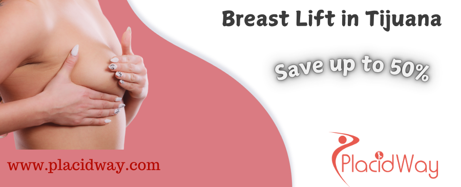 Breast Lift Cost in Tijuana Mexico